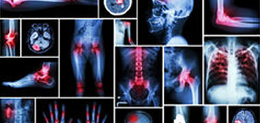 Neck Pain Treatments at NashuaPT